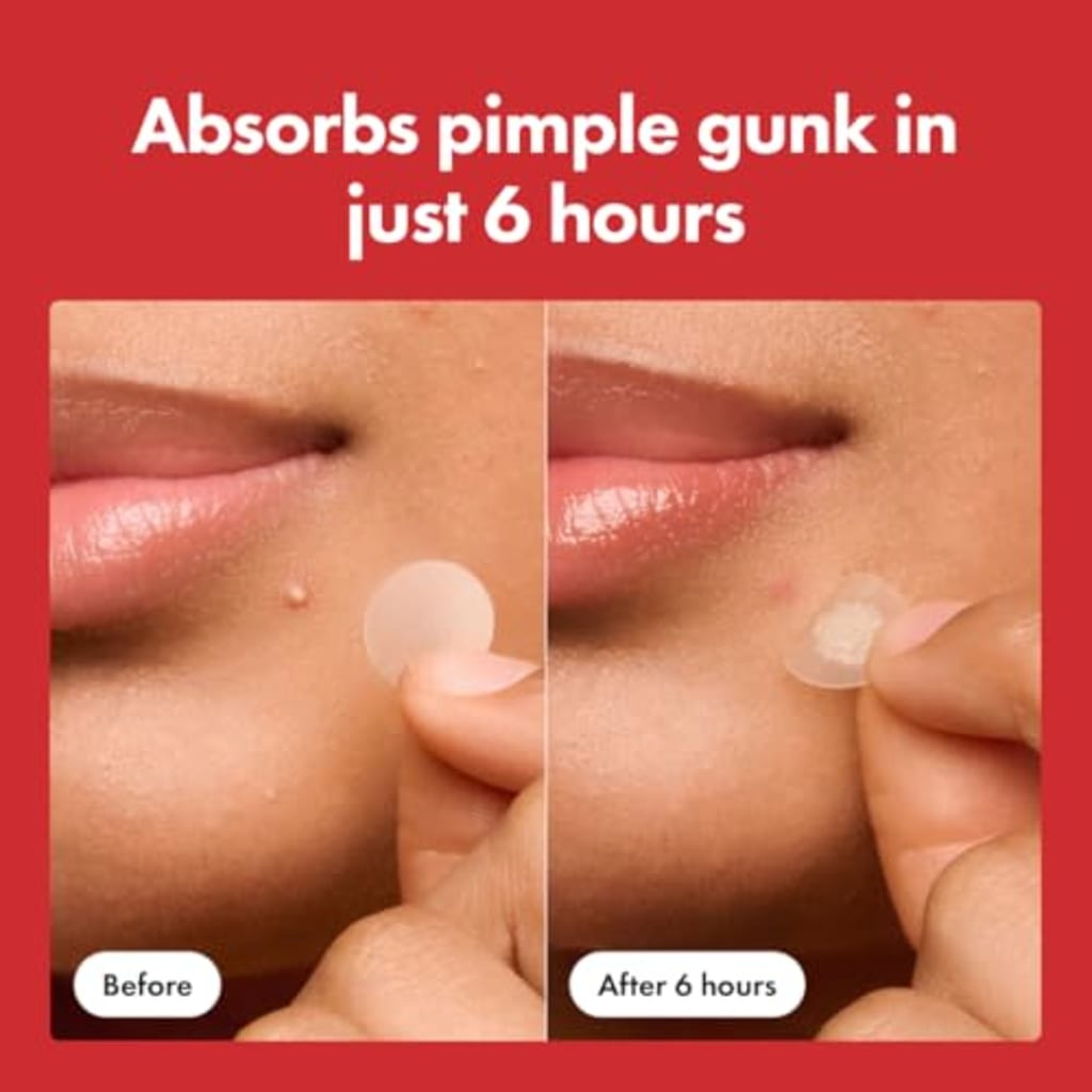 Luxeova™ Acne Pimple Patches