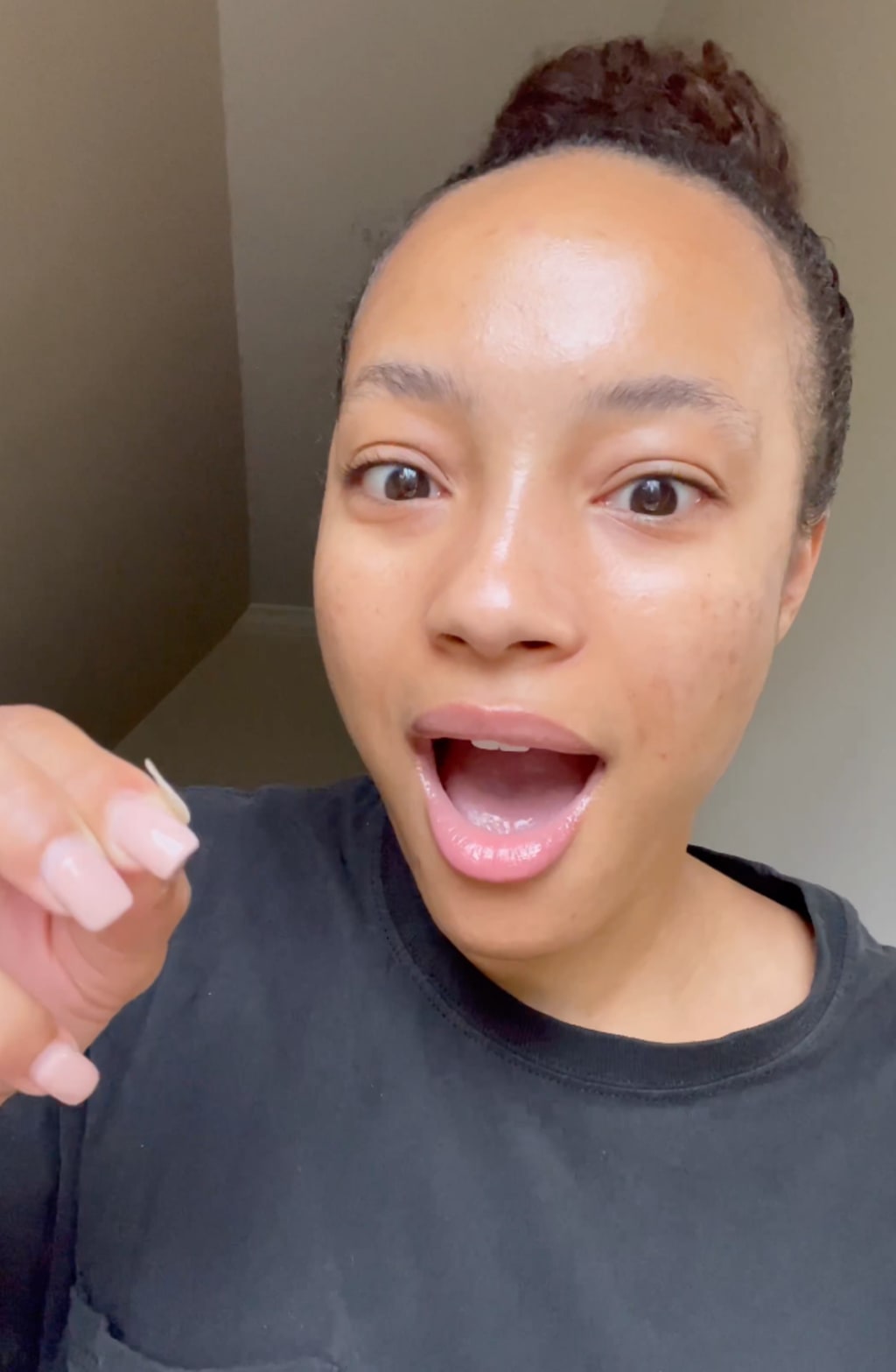 Luxeova™ Acne Pimple Patches