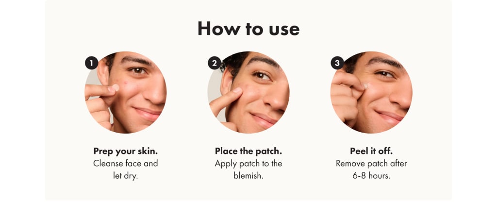 Luxeova™ Acne Pimple Patches